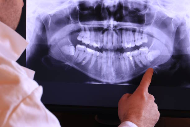 Best Emergency Denture Repair in Leadington, MO