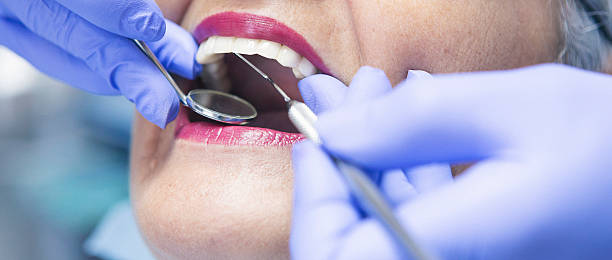 Professional Emergency Dental Service in MO